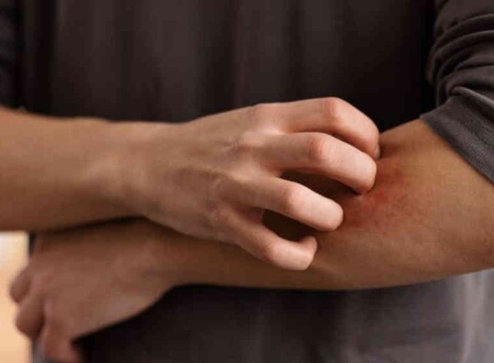 Manfaat dan Bahaya Menggaruk Kulit Gatal Menurut Penelitian Terbaru yang Harus Diketahui (Sumber : freepik)