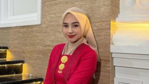 Bikin Pangling! Ria Ricis Akui Operasi Hidung (Sumber : IG/ Ria Ricis)