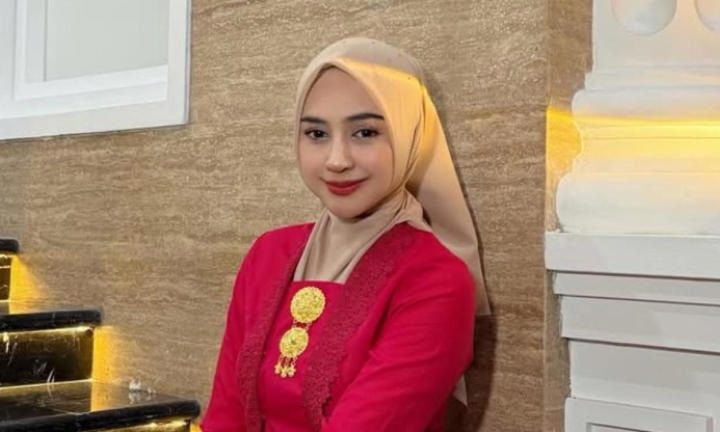 Bikin Pangling! Ria Ricis Akui Operasi Hidung (Sumber : IG/ Ria Ricis)