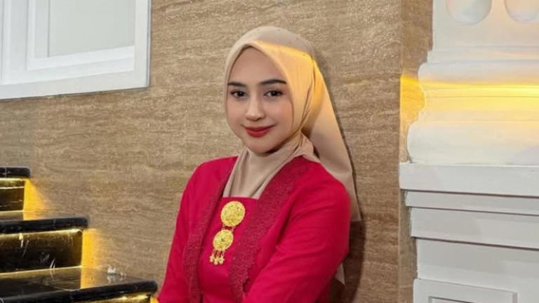 Bikin Pangling! Ria Ricis Akui Operasi Hidung (Sumber : IG/ Ria Ricis)