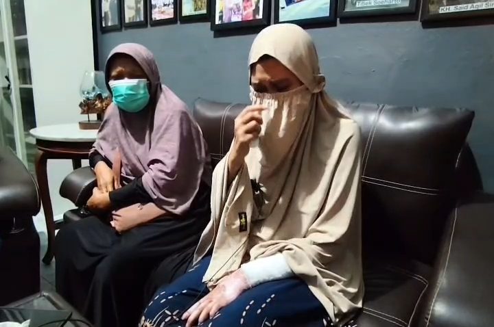 Seorang wanita muda menjadi korban penyiksaan oleh oknum anggota polisi hingga mengalami luka bakar di hampir separuh tubuhnya (Foto : Darfan)