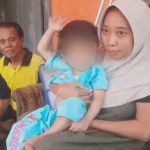 Perjuangan Sang Ibu, Kaki Patah Sambil Merawat Anak Tanpa Bola Mata (Foto : Darfan)